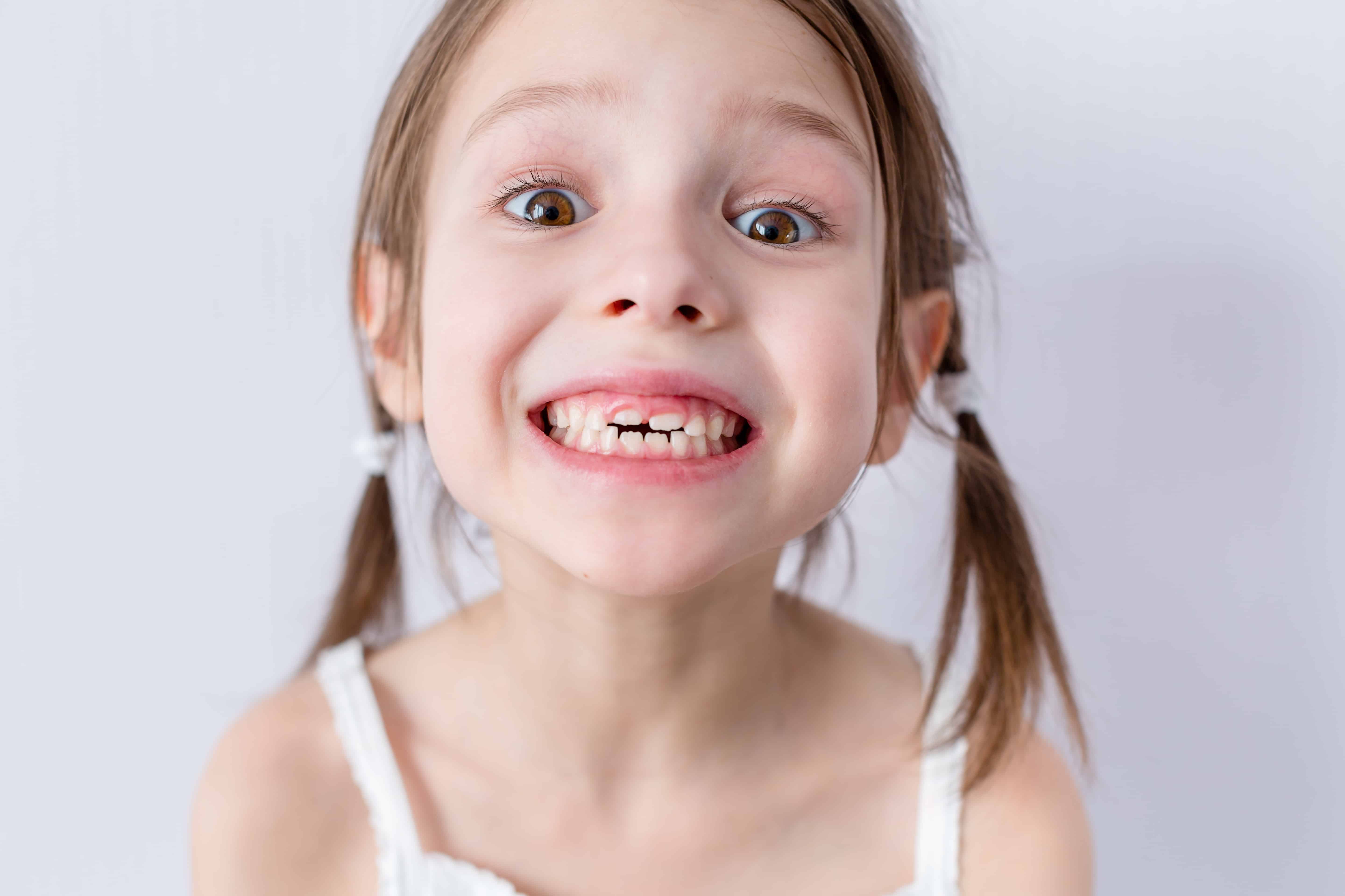 Close up portrait of preschooler girl with open mouth without milk tooth