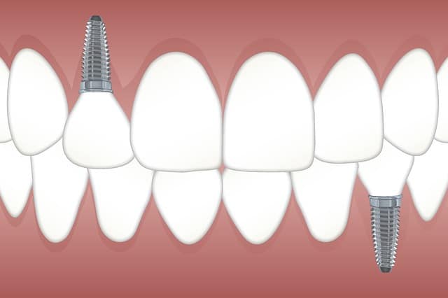 Teeth 3597679 640